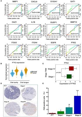 Carbon Ion Irradiation Enhances the Anti-tumor Efficiency in Tongue Squamous Cell Carcinoma via Modulating the FAK Signaling